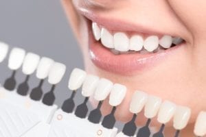 teeth whitening in Skokie Illinois