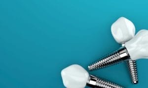 affordable dental implants in skokie, illinois
