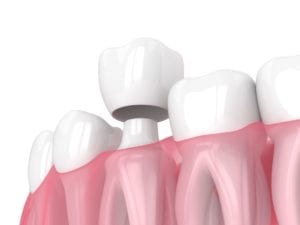 cosmetic dentistry in skokie, illinois