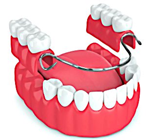 Partial Dentures in Skokie, Illinois